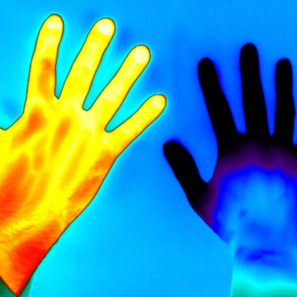 Thermal image showing two hands, one heat-mapped in bright yellow, orange, and red tones, and the other in cooler blue and purple tones, set against a blue background.